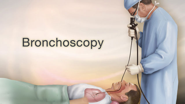 ADVANCE CERTIFICATE COURSE IN BRONCHOSCOPY