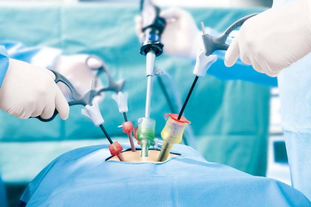 ADVANCE CERTIFICATE COURSE IN GYNECOLOGICAL LAPAROSCOPIC SURGERY